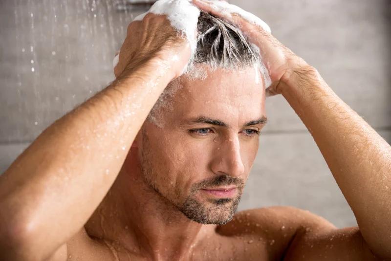 Men's Scalp Concerns