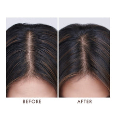 Oily Scalp Treatment 45 ml