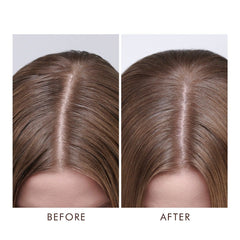 Dry Scalp Treatment 45 ml